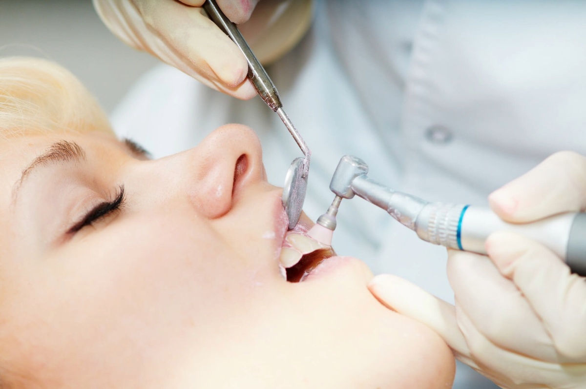 dental cleanings hamilton