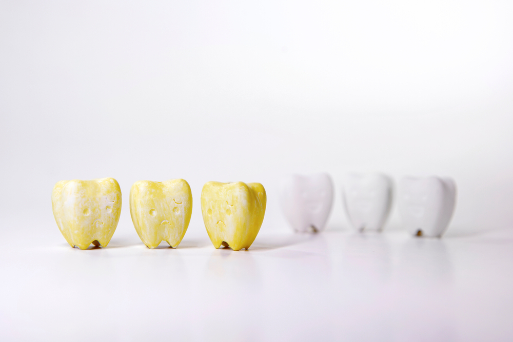 teeth whitening options and its cost